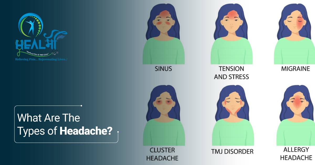 What Are The Types of Headaches?