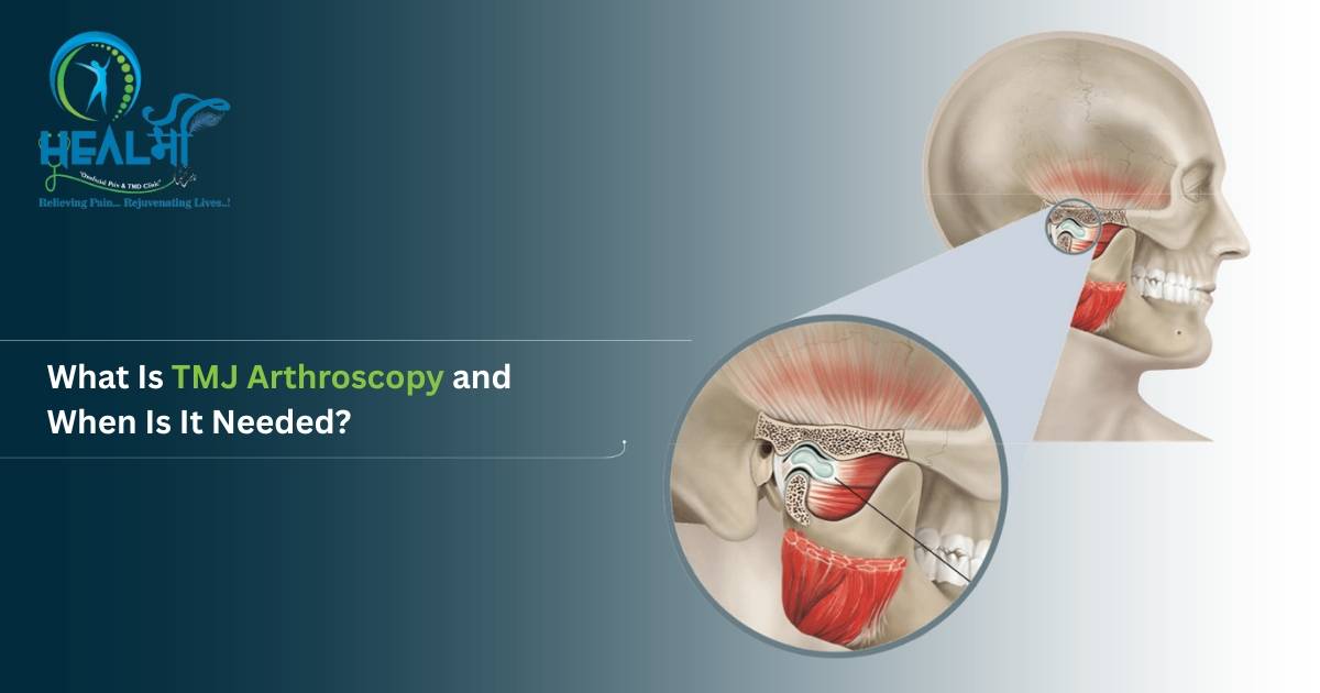 What Is TMJ Arthroscopy and When Is It Needed?