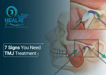 Signs You Need TMJ Treatment