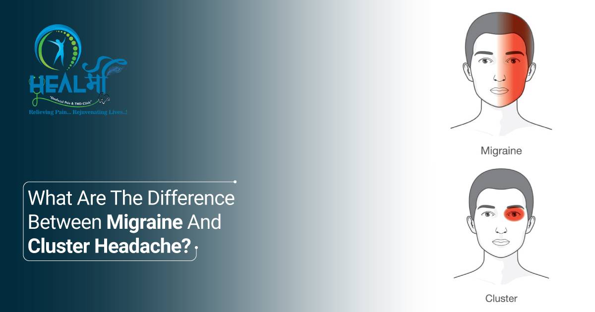 What Are The Differences Between Migraine And Cluster Headache?
