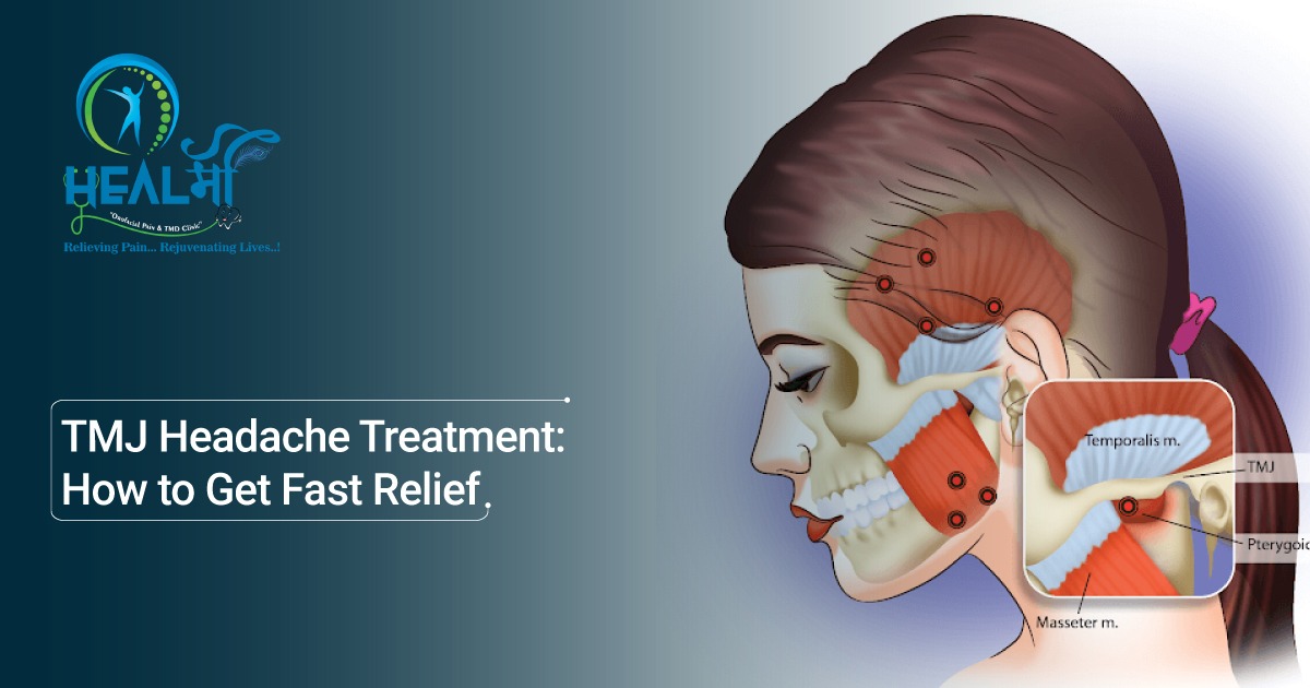 TMJ Headache Treatment: How to Get Fast Relief