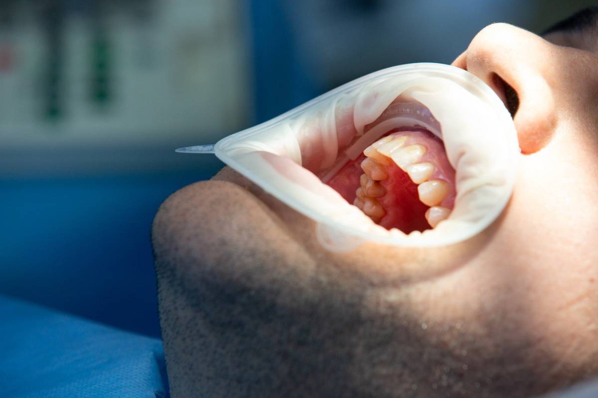 Oral Autoimmune Disease Treatment